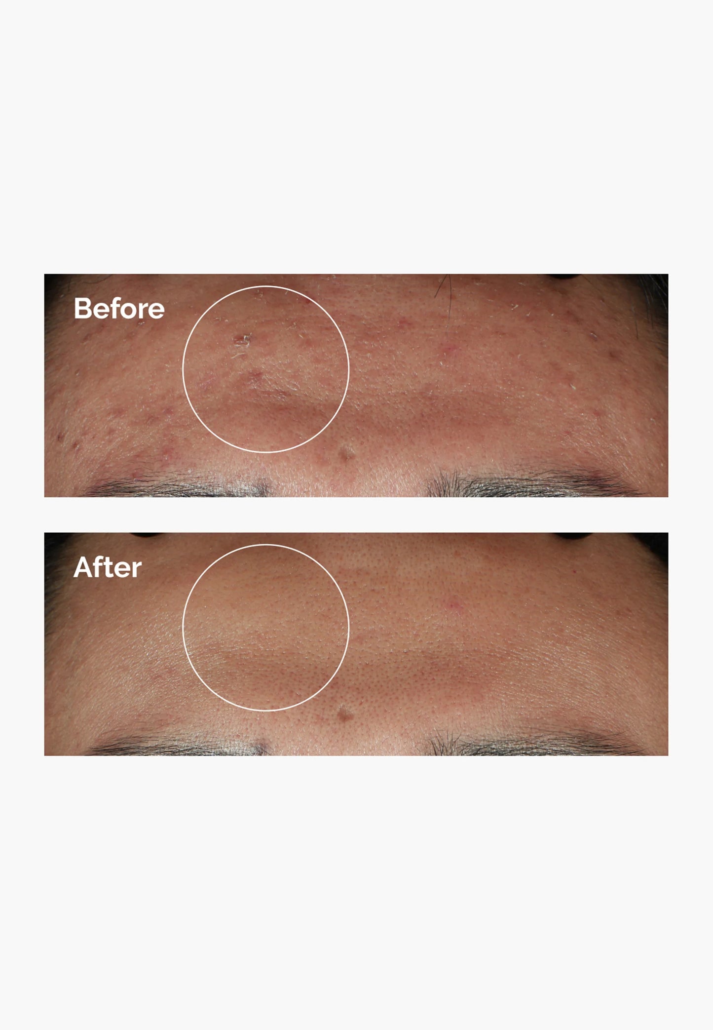 The Ordinary Niacinamide 10% + Zinc 1%